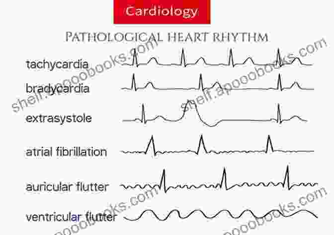 A Detailed Pathological Illustration Depicting A Heart With Various Anomalies Visualizing Disease: The Art And History Of Pathological Illustrations