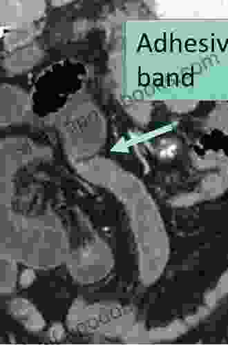 Imaging In Abdominal Surgery E