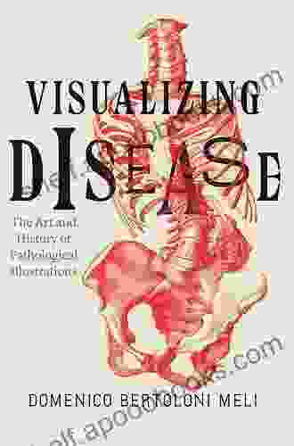 Visualizing Disease: The Art and History of Pathological Illustrations